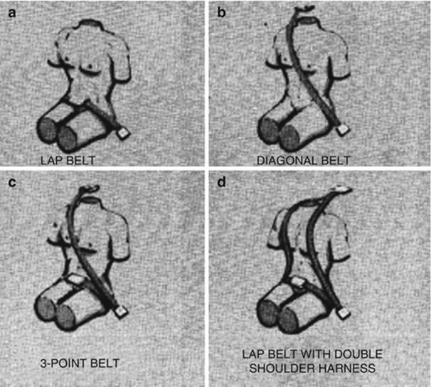 A322816_1_En_10_Fig11_HTML.jpg