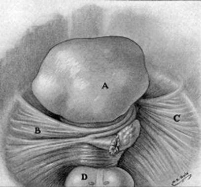 A322816_1_En_17_Fig1_HTML.jpg