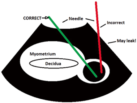 A321655_1_En_11_Fig4_HTML.gif