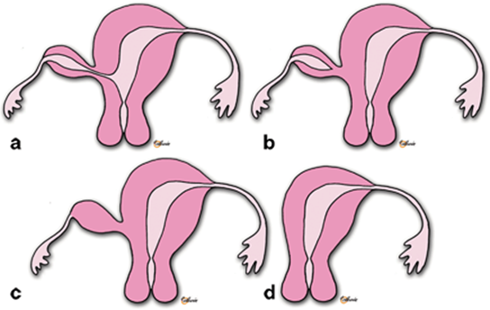 A321655_1_En_20_Fig1_HTML.gif
