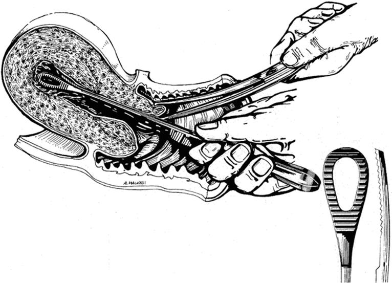 A339784_1_En_2_Fig6_HTML.gif