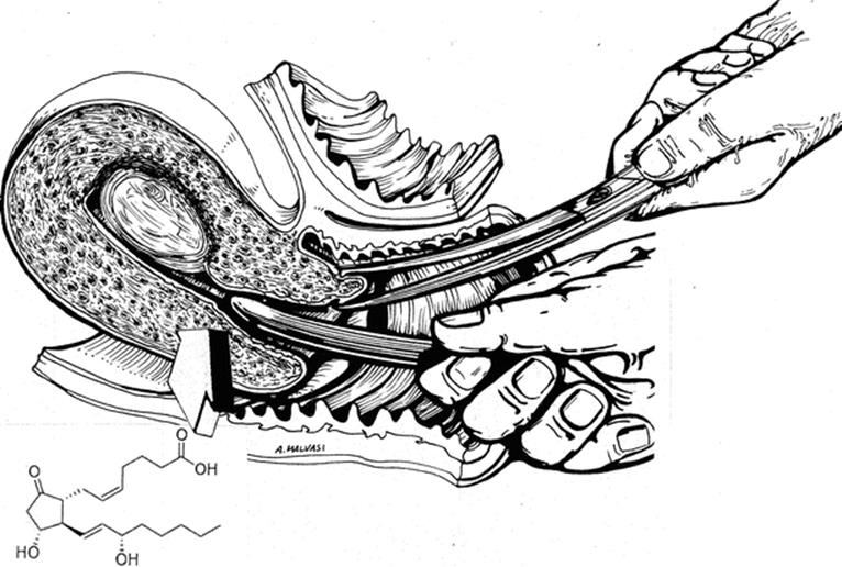 A339784_1_En_2_Fig28_HTML.gif