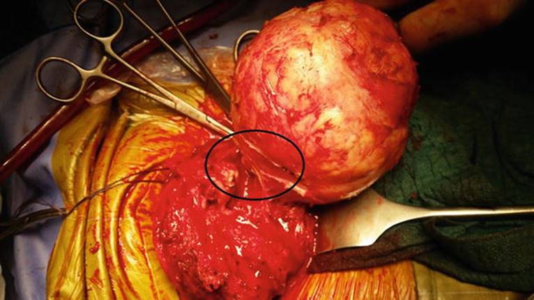 A339784_1_En_7_Fig20_HTML.jpg