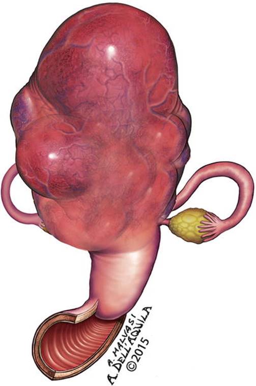 A339784_1_En_7_Fig40_HTML.jpg