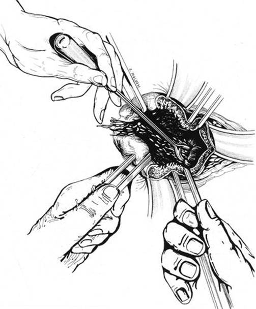 A339784_1_En_8_Fig19_HTML.jpg