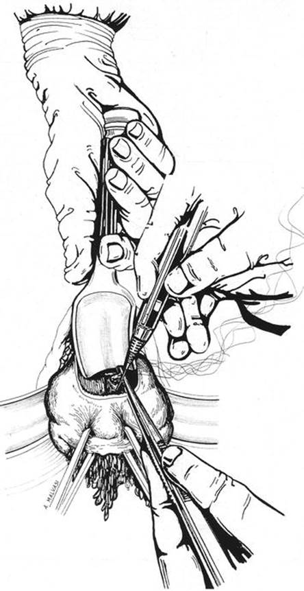 A339784_1_En_8_Fig23_HTML.jpg