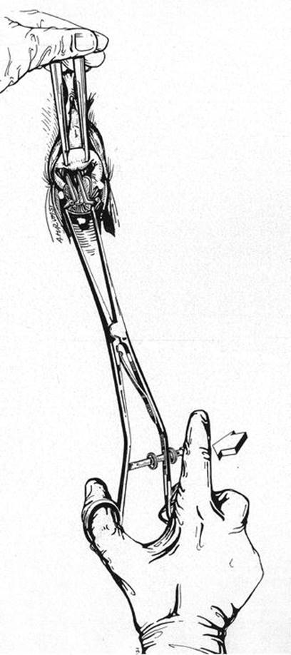 A339784_1_En_8_Fig25_HTML.jpg