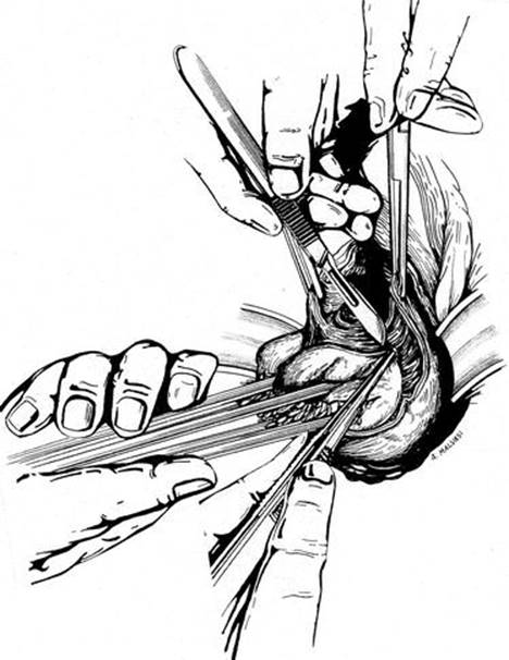 A339784_1_En_8_Fig34_HTML.jpg