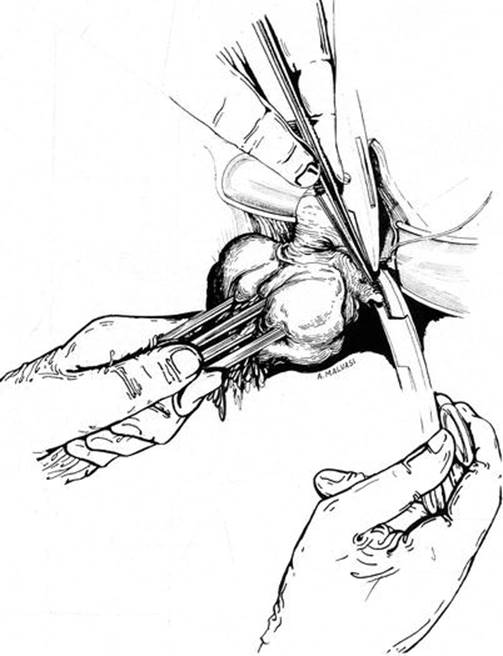 A339784_1_En_8_Fig36_HTML.jpg