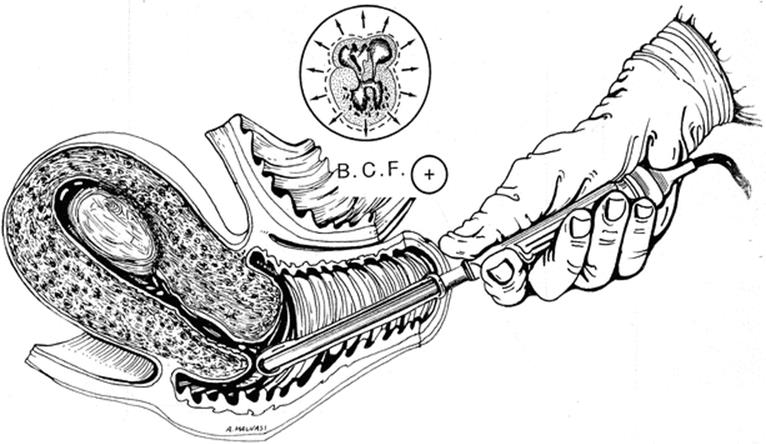 A339784_1_En_12_Fig5_HTML.gif