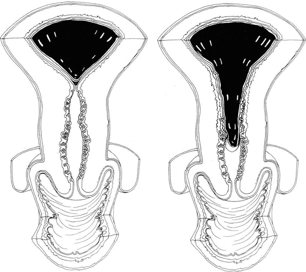 A339784_1_En_12_Fig12_HTML.gif