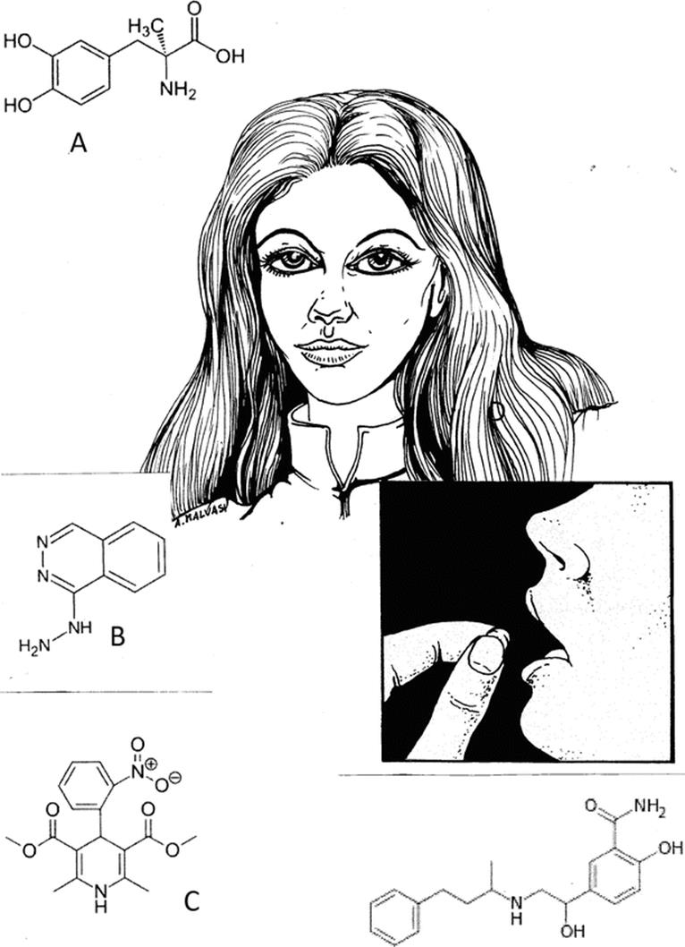 A339784_1_En_15_Fig19_HTML.gif
