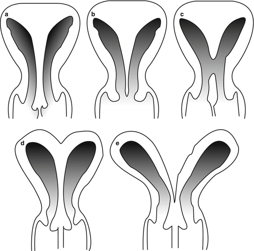 A304172_1_En_3_Fig1_HTML.gif