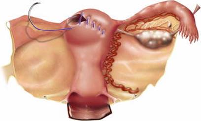 A304172_1_En_14_Fig9_HTML.jpg