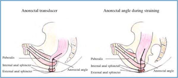 A978-88-470-5441-7_12_Fig4_HTML.jpg