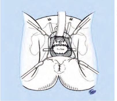 A978-88-470-5441-7_17_Fig2_HTML.jpg