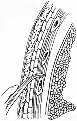 000852