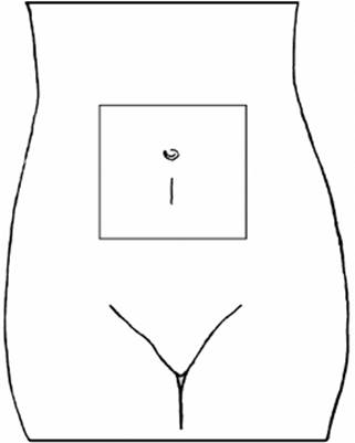 000363