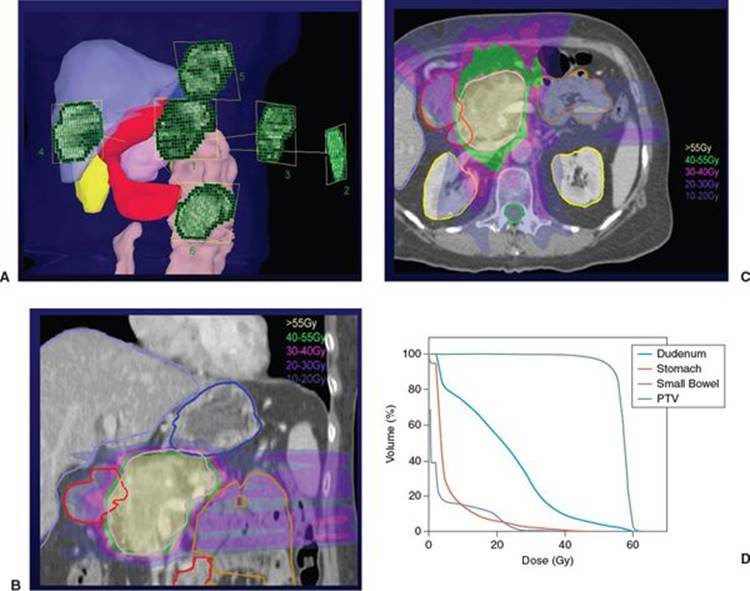 Pancreas - Practical Essentials of Intensity Modulated Radiation ...