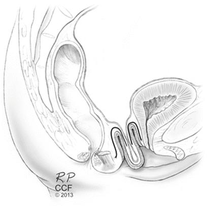 A321341_1_En_20_Fig1_HTML.gif