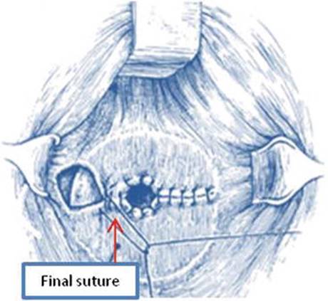 A308862_1_En_7_Fig60_HTML.jpg
